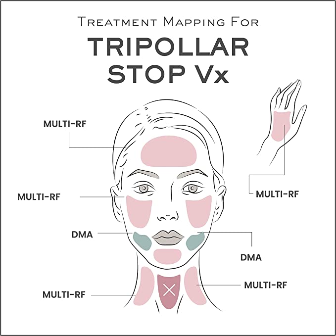 Tripollar Stop Vx - Radio Frequency Skin Tightening and Facial Machine Tripollar